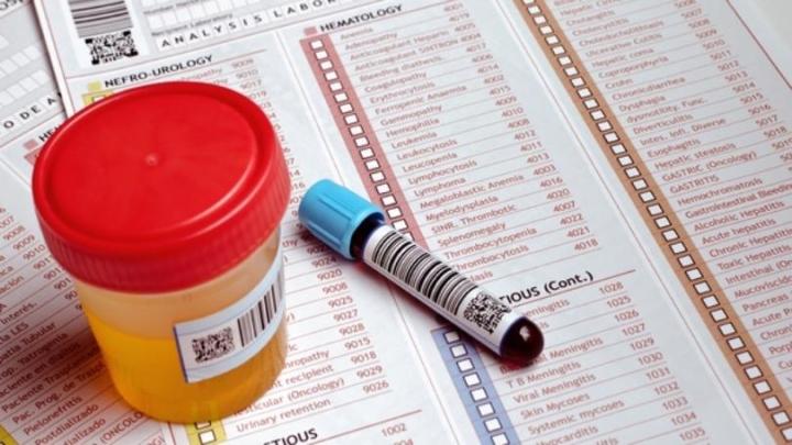 Picture for Investigating boxing’s unhealthy relationship with performance enhancing drugs